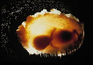 Embryon_de_sept_semaines